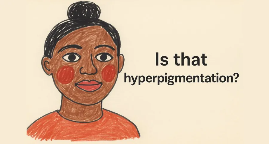 “Is That Hyperpigmentation?” – The Phrase That Conquered TikTok in 2025