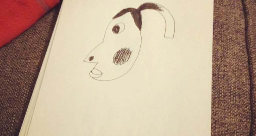 The Hyperpigmentation Drawing Meme: The Internet’s Unlikely Masterpiece of 2025 The Hyperpigmentation Drawing Meme: The Internet’s Unlikely Masterpiece of 2025